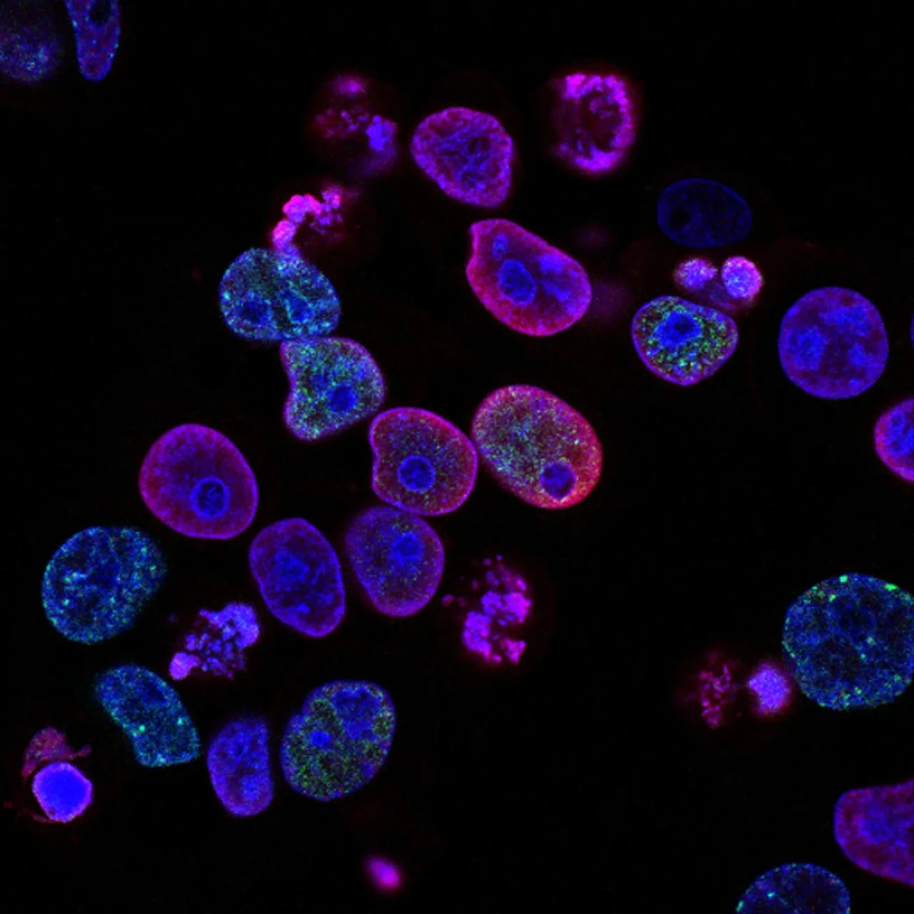 Fluorescent image of cells under a microscope, showing nuclei in blue, cytoplasm in purple, and green spots indicating specific cellular structures or proteins, all set against a black background.