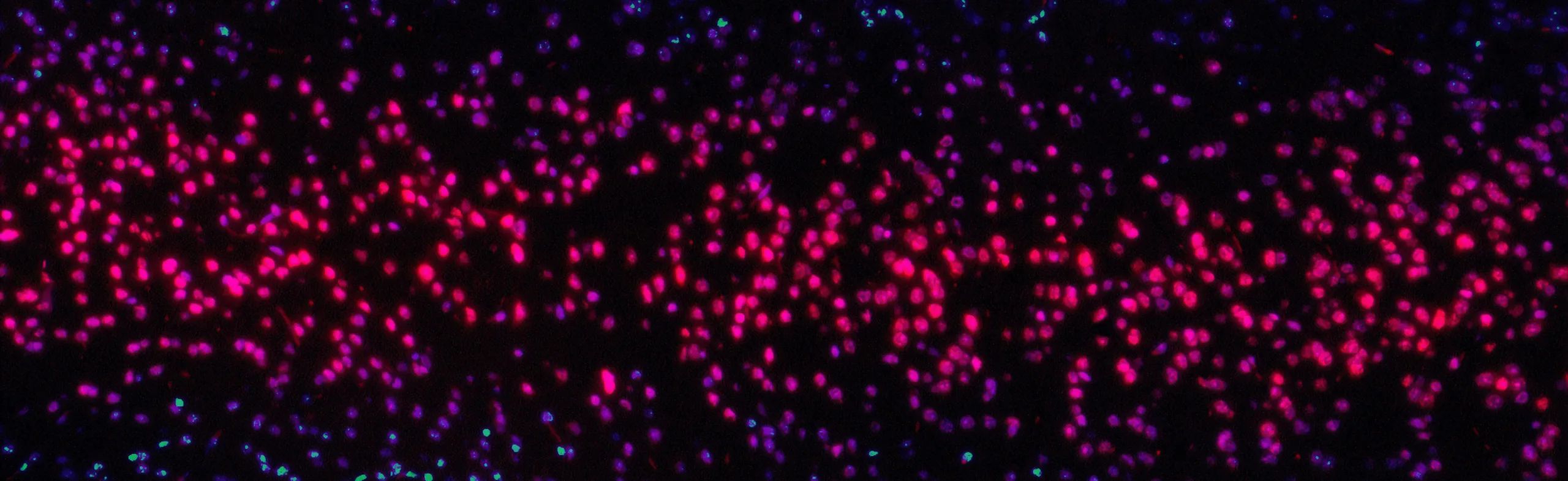 Fluorescent microscopic image showing clusters of brightly glowing pink, purple, and blue dots against a black background, representing stained cells in a biological sample.